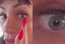 maya-massafera-exibe-resultado-de-cirurgia-para-mudar-cor-dos-olhos