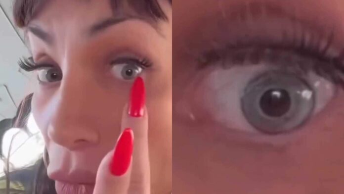 maya-massafera-exibe-resultado-de-cirurgia-para-mudar-cor-dos-olhos